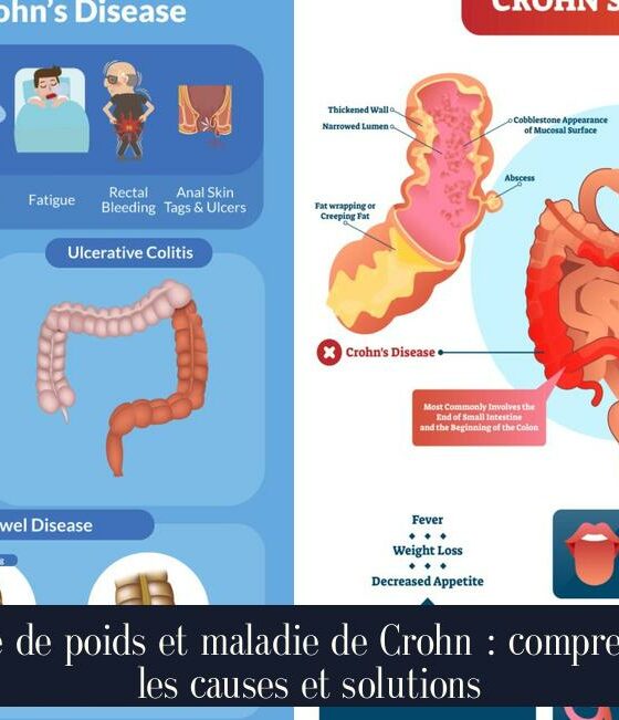 Prise de poids et maladie de Crohn : comprendre les causes et solutions