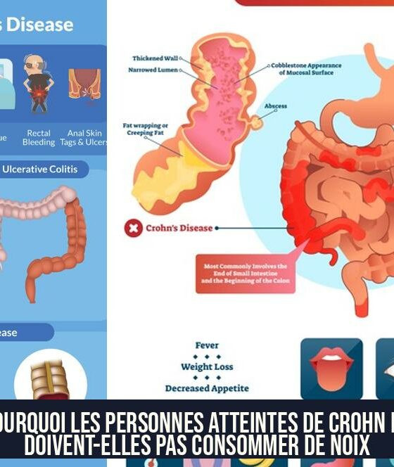Pourquoi les personnes atteintes de Crohn ne doivent-elles pas consommer de noix