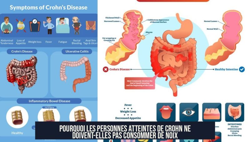 Pourquoi les personnes atteintes de Crohn ne doivent-elles pas consommer de noix